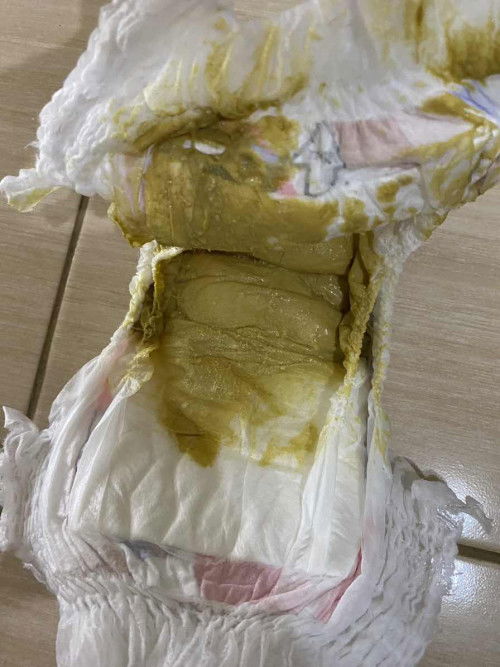 Alergi sufor atau tidak