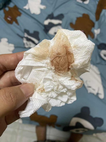 ควรไปหาหมอมั้ยคะ