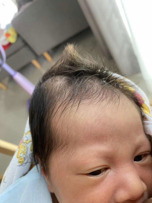 คลอดลูกมาแล้วหัวปูดค่ะ