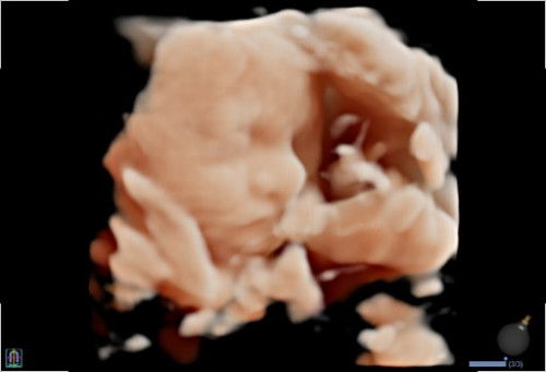 Ada yg bisa baca keseluruhannya ngga?