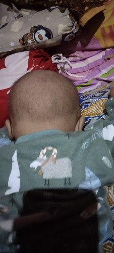 Kepala bayi
