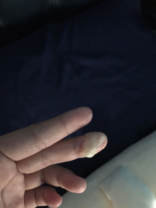 Keluar lendir seperti ingus