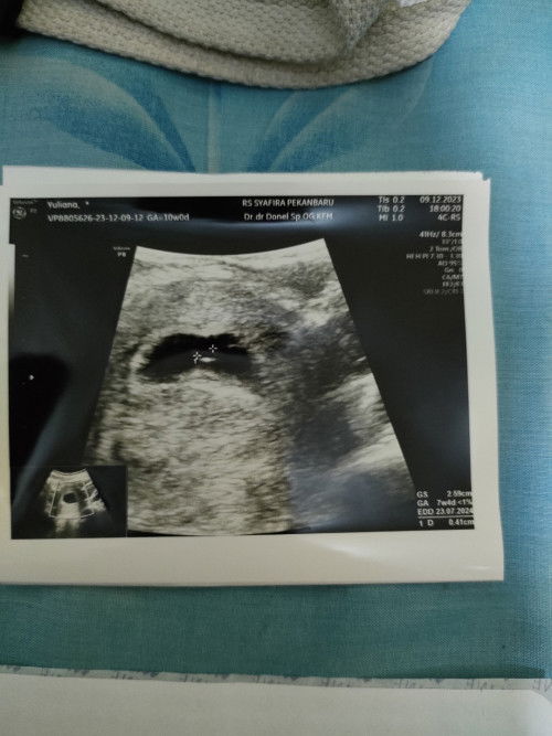 Punya pengalaman yang sama ga?