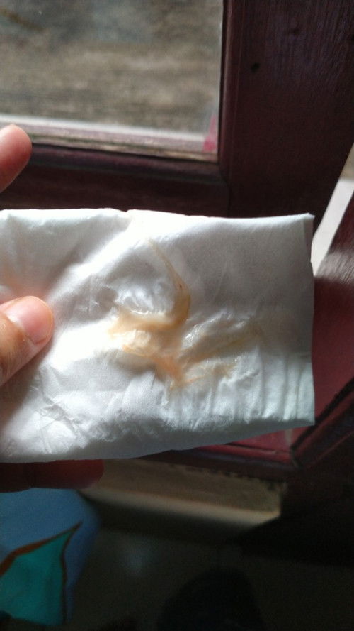 APA INI LENDIR AKAN MELAHIRKAN??