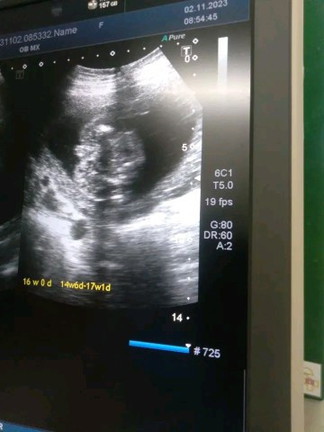 โชว์เพศลูก