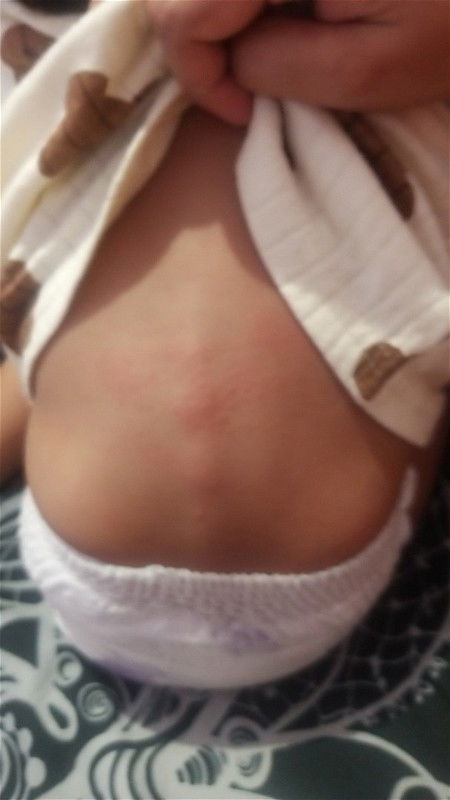 Usia 6 bulan belum bisa duduk tegak