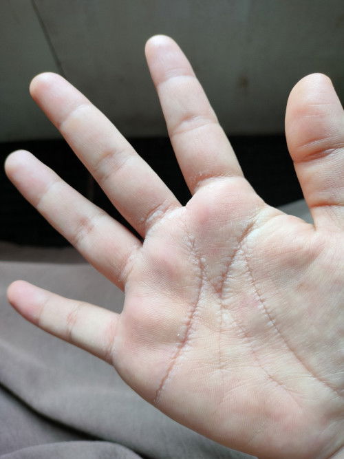 bund ada yang tau gak?