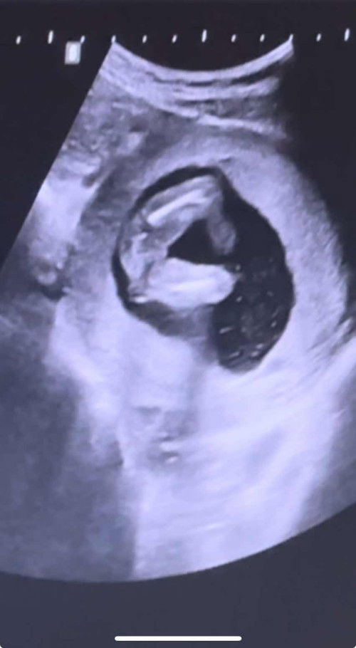 แบบนี้เพศหญิงมั้ยคะ 🥹