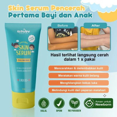 Skincare baby usia 4 bulan