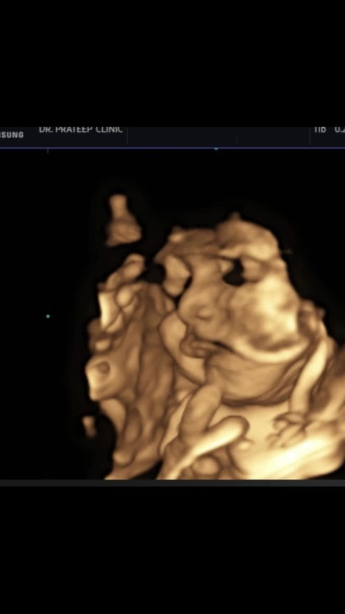 ปากน้องเป็นแบบนี้ปกติใช่ไหมคะ