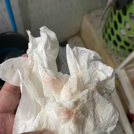 มีมูกเลือดออกมาแบบนี้ต้องไปหาหมอไหมค่ะ