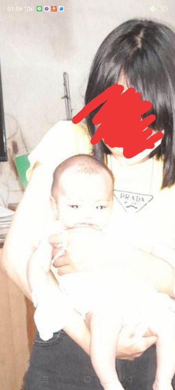 มะเร็งจอประสาทตาคือว่าถ่ายแฟรชมาละตาลูกเป็นแบบนี่เลยค่ะกะงวลมาก มีใครมีประสบการณ์บ้างมั้ยคะแนะนำที