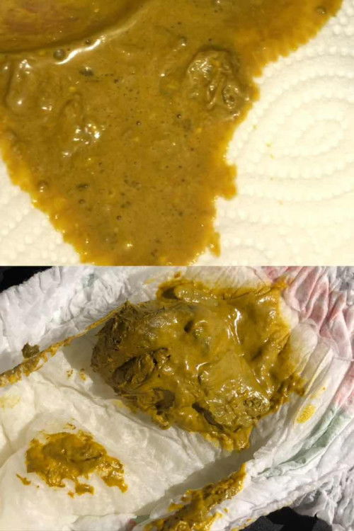 แม่ๆค่ะน้อง1เดือน23วัน นมแม่ วันนี้วันที่8น้องพึ่งถ่ายอุจจาระ แบบนี้ปกติไหมค่ะ