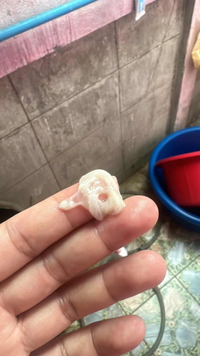37+3 มีมูกแบบนี้ ใกล้แตกยังคะ