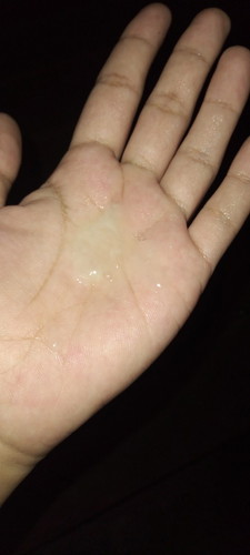 คลอดก่อนกำหนด