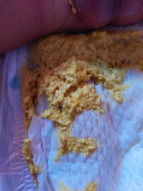 Sering BAB apakah normal usia 30 hari