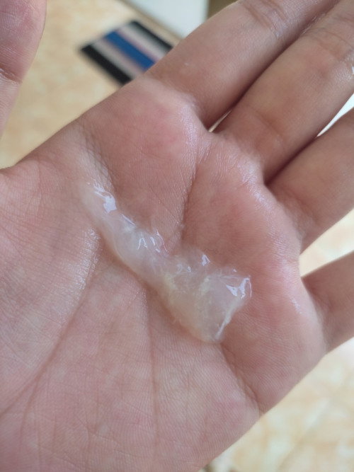 Apa ini mucus plug?