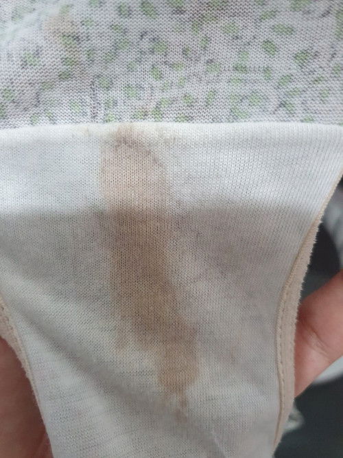 Bun, 38 minggu hpht 18 maret,,keluar cairan merah, knpa ya? Tapi belum ada mules