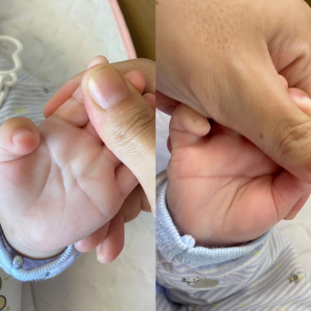 Telapak tangan bayi