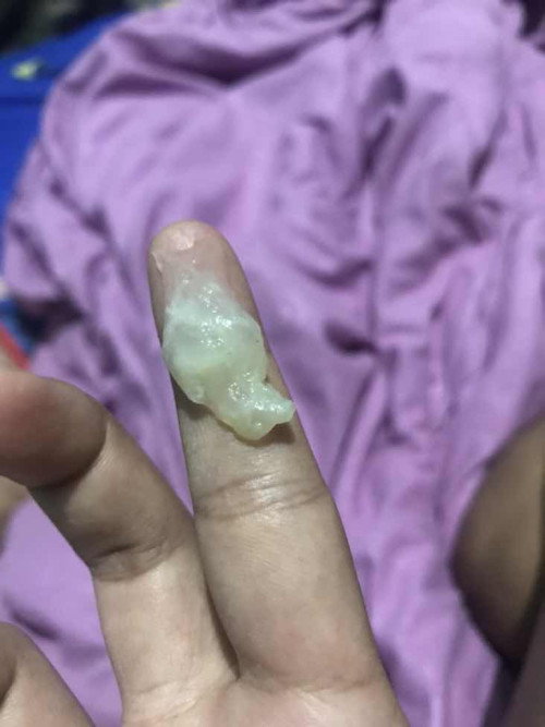 Itu lendir apa yaaa?