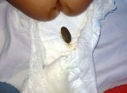 Keluar pups padat dan sedikit