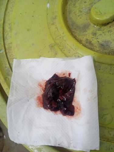 Blood discharge