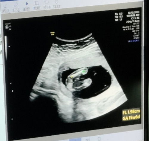 รบกวนแม่ๆช่วยดูเพศหน่อยค่ะ
 โรงพยาบาลที่เราฝากครรภ์หมอไม่บอกเพศ
