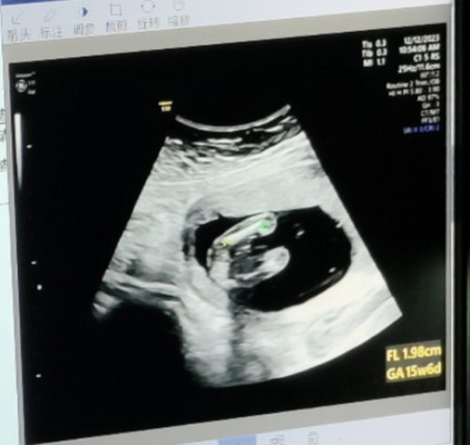 รบกวนแม่ๆช่วยดูเพศหน่อยค่ะ
 โรงพยาบาลที่เราฝากครรภ์หมอไม่บอกเพศ