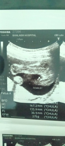 ช่วยดูหน่อยคะ ว่าเป็นผู้หญิงหรือผู้ชาย