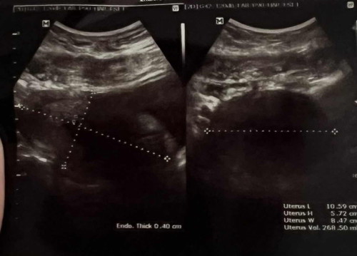 ช่วยดูภาพอัลตราซาวด์หน่อยค่ะ