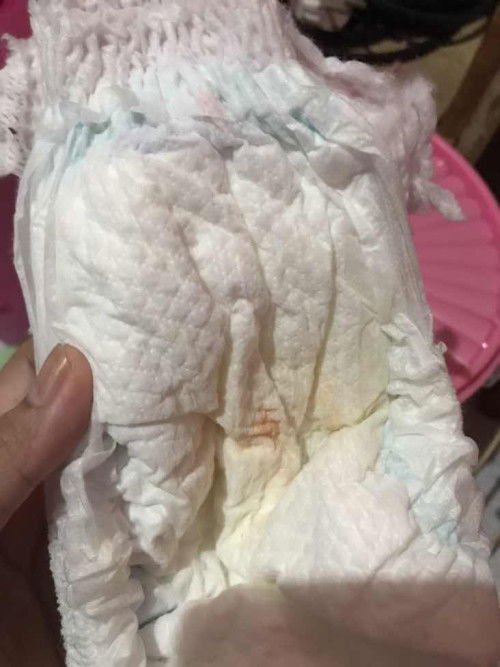 Bercak merah di pampers
