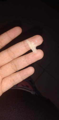 อันนี้มูกหรือตกขาวคะ