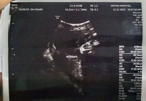 แม่ๆช่วยดูเพศให้หน่อยค่ะ