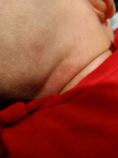 dikepala belakang dekat leher ada bercak warna merah itu apa?