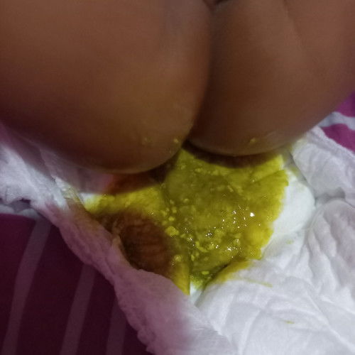 Bab bayi lebih dri 5kali