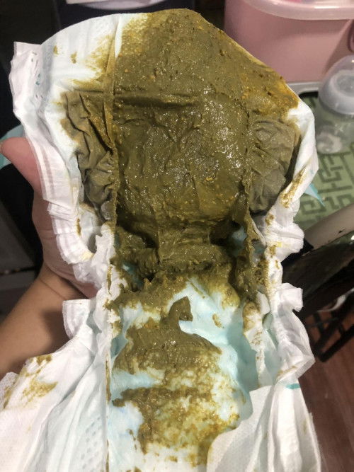 Kulay ng Poops ni baby