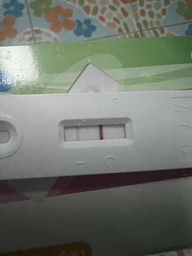 มีใครเจอแบบนี้บ้าง