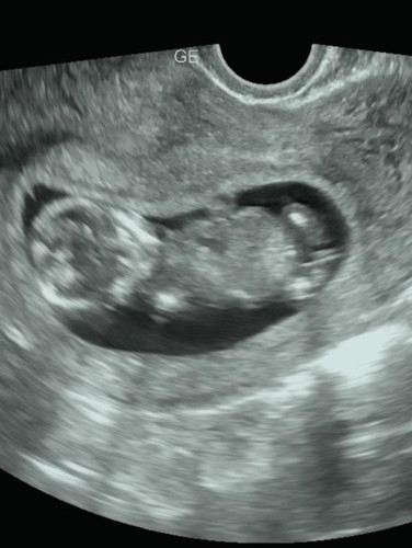 Gender ni baby