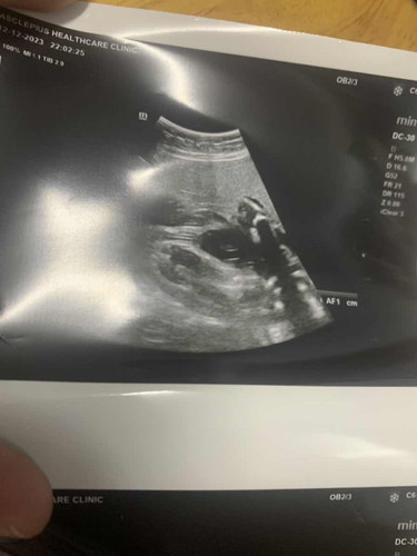 pinjam mata mommy ii semua sekejap