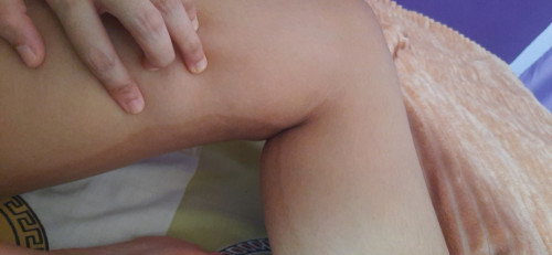 Cara ilangin area yang menghitam