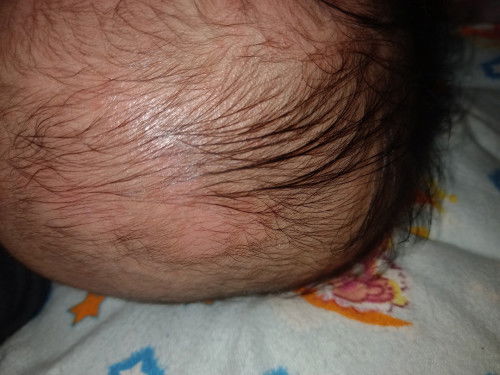 Ask lang po mga mii.