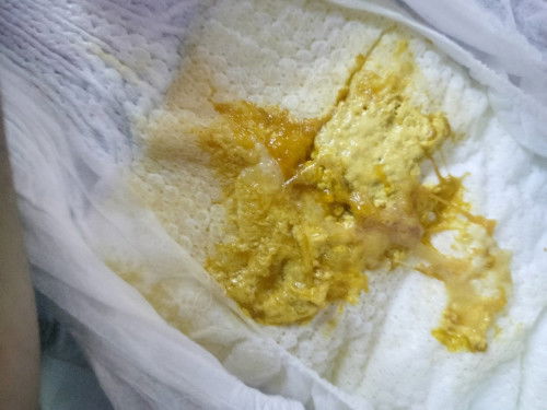 Dumi na parang may sipon