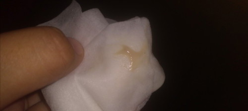 Mucus plug?