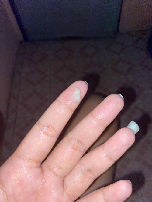 แบบนี้คืออะไรคะ มีมา4วันเเล้ว ตอน37+1