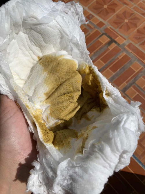 อึแบบนี้ผิดปกติมั้ย