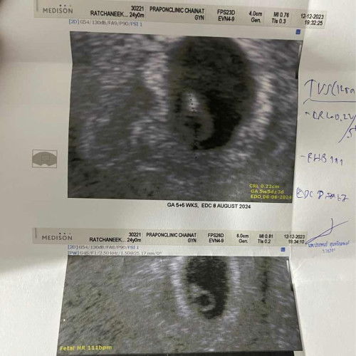 แบบนี้ปกติมั้ยคะ