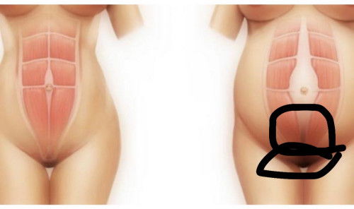 ปวดหน่วงๆปวดจี๊ด