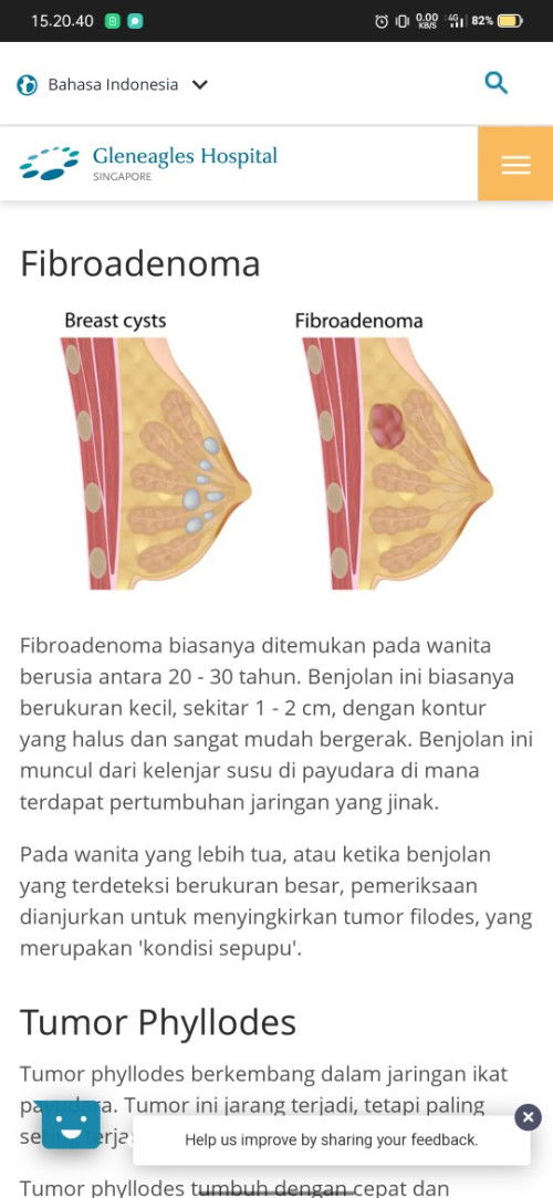 benjolan pada payudara