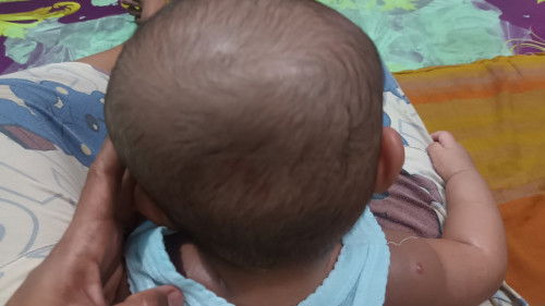 Kepala bayi 0eyang sebelah