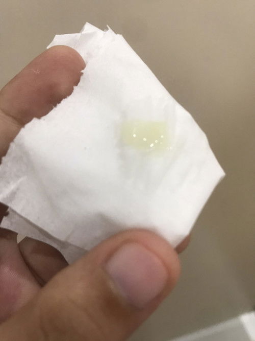 ตกขาวหรือมูกใสค่ะ